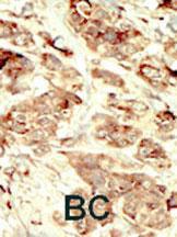 Anti-STK35 Rabbit Polyclonal Antibody (PE (Phycoerythrin))