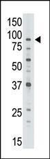 Anti-ABCB7 Rabbit Polyclonal Antibody (FITC (Fluorescein Isothiocyanate))