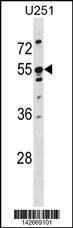 Anti-KRT86 Rabbit Polyclonal Antibody (HRP (Horseradish Peroxidase))