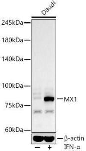 Western blot analysis of Daudi, using Anti-MX1 Antibody (A11481) at 1:600 dilution. Daudi cells were treated by IFN-alpha (100 ng/ml) at 37°C for 30 minutes after serum-starvation overnight. The secondary antibody was Goat Anti-Rabbit IgG H&L Antibody (HRP) at 1:10,000 dilution.