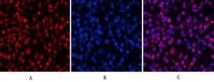 Immunofluorescence analysis of human lung cancer tissue using Anti-Histone H3 (acetyl Lys9) Antibody (red) at 1:200 (4°C overnight). Cy3 labelled secondary antibody was used at 1:300 (RT 50min). Panel A: Target. Panel B: DAPI. Panel C: Merge.