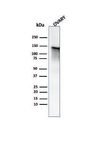 Western blot analysis of human ovary tissue lysate using Anti-Caldesmon Antibody