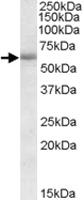 Anti-CDH23 Goat Polyclonal Antibody