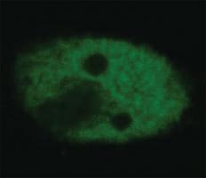 Anti-TP53 Mouse Monoclonal Antibody (FITC (Fluorescein isothiocyanate)) [clone: BP53-12]