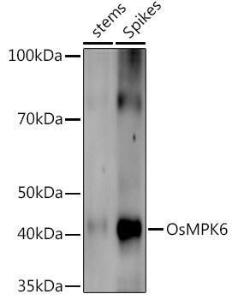 Western blot analysis of extracts of various tissues from the japonica rice (Oryza sativa L. ) variety Zhonghua 11, using Anti-MPK6 Antibody (A309832) at 1:1,000 dilution. The secondary antibody was Goat Anti-Rabbit IgG H&L Antibody (HRP) at 1:10,000 dilution.