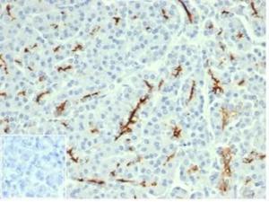 Immunohistochemical analysis of formalin-fixed, paraffin-embedded human pancreas tissue using Anti-CFTR Antibody [CFTR/6477R] Inset: PBS instead of the primary antibody Secondary antibody negative control