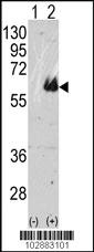 Anti-MAPT Rabbit Polyclonal Antibody