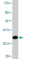 Anti-ZNF224 Mouse Monoclonal Antibody [clone: 2C12]