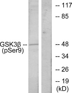 Antibody anti-GSK3 beta phospho SER9