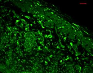 Immunohistochemistry analysis of mouse backskin, fixed in Bouin's fixative solution and paraffin-embedded The Primary Antibody used was Anti-Heme Oxygenase 1 Antibody [1F12-A6] (A304771) at 1:100 for 1 hour at room temperature