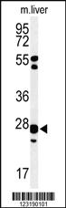 Anti-GSTK1 Rabbit Polyclonal Antibody