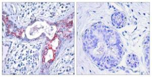 Antibody anti-GSK3 beta phospho SER9