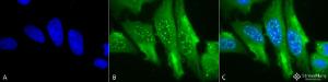 Immunocytochemistry/Immunofluorescence analysis of human cervical cancer cell line (HeLa), fixed in 2% formaldehyde for 20 minutes at room temperature, using Anti-Heme Oxygenase 1 Antibody [1F12-A6] (A304771), at 1:100 for 12 hours at 4°C