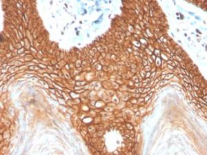 Anti-E Cadherin Rabbit Recombinant Antibody [clone: CDH1/4398R]