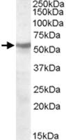 Anti-CHRNB1 Goat Polyclonal Antibody