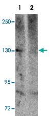 Anti-NLRP5 Rabbit Polyclonal Antibody