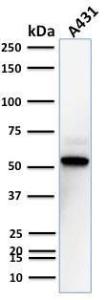 Western blot analysis of A431 cell lysate using Anti-TOX3 Antibody [TOX3/1123]