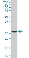 Anti-SPI1 Mouse Monoclonal Antibody [clone: 2G1]