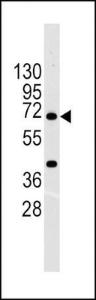 Anti-ABCG2 Rabbit Polyclonal Antibody