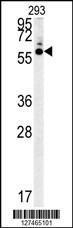 Anti-HTR3C Rabbit Polyclonal Antibody (APC (Allophycocyanin))