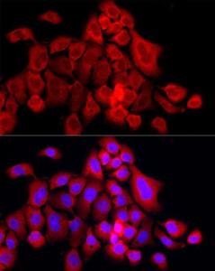 Immunofluorescence analysis of A431 cells using Anti-MX1 Antibody (A11481) at a dilution of 1:50 (40x lens). DAPI was used to stain the cell nuclei (blue).