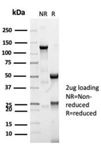 SDS-PAGE analysis of Anti-CFTR Antibody [CFTR/7003R] under non-reduced and reduced conditions; showing intact IgG and intact heavy and light chains, respectively. SDS-PAGE analysis confirms the integrity and purity of the antibody.