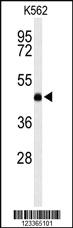 Anti-LCAT Rabbit Polyclonal Antibody