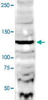 Anti-DIAPH2 Rabbit Polyclonal Antibody