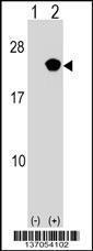 Anti-RAP2B Rabbit Polyclonal Antibody (PE (Phycoerythrin))