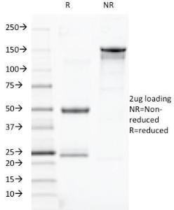 SDS-PAGE analysis of Anti-TOX3 Antibody [TOX3/1123] under non-reduced and reduced conditions; showing intact IgG and intact heavy and light chains, respectively. SDS-PAGE analysis confirms the integrity and purity of the antibody