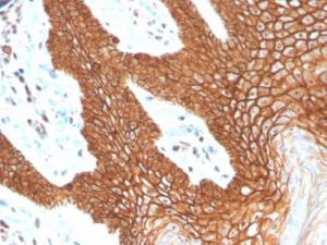 Anti-E Cadherin Rabbit Recombinant Antibody [clone: CDH1/4398R]