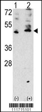 Anti-VEGFC Rabbit Polyclonal Antibody