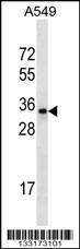 Anti-OR2A42 Rabbit Polyclonal Antibody (Biotin)