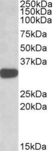 Antibody anti-TIPRL 100 µg