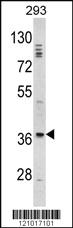 Anti-DLX2 Rabbit Polyclonal Antibody