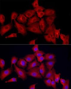 Immunofluorescence analysis of A-549 cells using Anti-MX1 Antibody (A11481) at a dilution of 1:50 (40x lens). DAPI was used to stain the cell nuclei (blue).