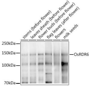 Anti-SHL2 antibody