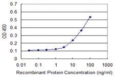 Anti-PANK2 Mouse Monoclonal Antibody [clone: 2B12]