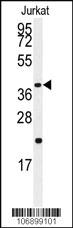 Anti-UMOD Rabbit Polyclonal Antibody