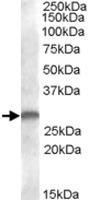 Anti-CLEC1B Goat Polyclonal Antibody