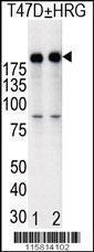 Anti-ERBB2 Rabbit Polyclonal Antibody (HRP (Horseradish Peroxidase))