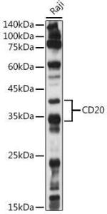 Western blot analysis of extracts of Raji cells, using Anti-CD20 Antibody (A11482) at 1:1,000 dilution The secondary antibody was Goat Anti-Rabbit IgG H&L Antibody (HRP) at 1:10,000 dilution Lysates/proteins were present at 25 µg per lane