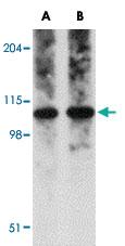 Anti-OTUD4 Rabbit Polyclonal Antibody