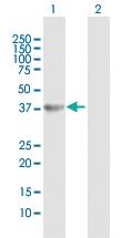 Anti-HAO2 Rabbit Polyclonal Antibody