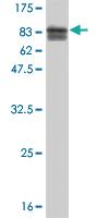 Anti-TOE1 Mouse Monoclonal Antibody [clone: 2D7]