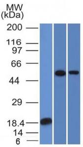 Western blot analysis of (A) recombinant TOX3 protein, (B) A549 cell lysate, and (C) A431 cell lysate using Anti-TOX3 Antibody [TOX3/1124]