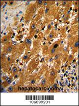 Anti-UMOD Rabbit Polyclonal Antibody