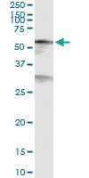 Anti-CREB5 Polyclonal Antibody Pair