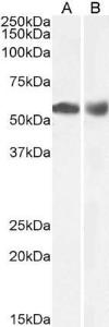 Anti-HDAC1 Antibody (A84192) (01 µg/ml) staining of Human Duodenum (A) and Lymph Node (B) lysate (35 µg protein in RIPA buffer) Primary incubation was 1 hour Detected by chemiluminescence