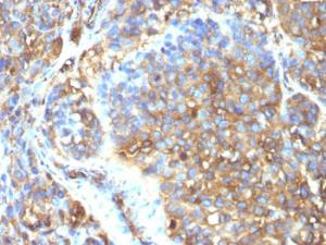 Anti-Moesin antibody